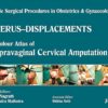 Single Surgical Procedures in Obstetrics and Gynaecology 16: A Colour Atlas of Supravaginal Cervical Amputation (Nadkarni’s): Single Surg.Proced In Obs&Gyne (PDF)