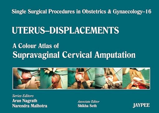 Single Surgical Procedures in Obstetrics and Gynaecology 16: A Colour Atlas of Supravaginal Cervical Amputation (Nadkarni’s): Single Surg.Proced In Obs&Gyne (PDF)