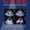 CASE PDF