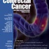 Clinical Colorectal Cancer PDF