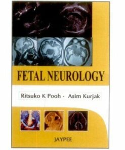 Fetal Neurology (PDF)