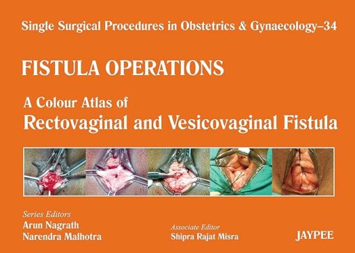 Single Surgical Procedures in Obstetrics and Gynaecology–34: Fistula Operations-A Colour Atlas of Rectovaginal and Vesicovaginal Fistula: A Colour Atlas … & Vesicovaginal Fistula,Fistula Operations 1st Edition (PDF)