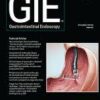 Gastrointestinal Endoscopy PDF