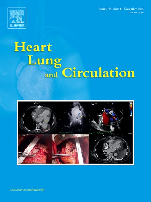 Heart, Lung and Circulation PDF