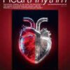 Heart Rhythm PDF