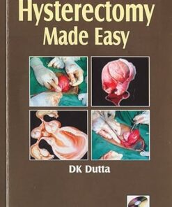 Hysterectomy Made Easy (SCAN PDF)