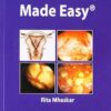 Hysteroscopy Made Easy (PDF)