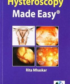 Hysteroscopy Made Easy (PDF)