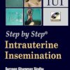 Intrauterine Insemination (Step by Step) (PDF)