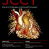 Journal of Cardiovascular Computed Tomograph PDF