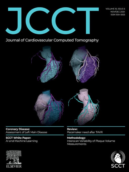 Journal of Cardiovascular Computed Tomograph PDF