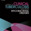 Journal of Clinical Tuberculosis and Other Mycobacterial Diseases PDF