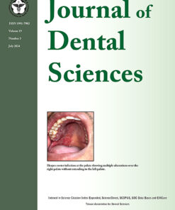 Journal of Dental Sciences PDF