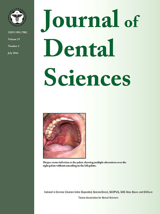 Journal of Dental Sciences PDF