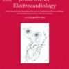 Journal of Electrocardiology PDF