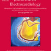 Journal of Electrocardiology PDF