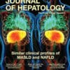 Journal of Hepatology PDF