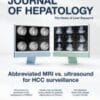 Journal of Hepatology PDF