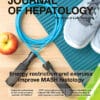 Journal of Hepatology PDF