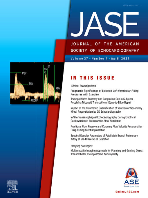 Journal of the American Society of Echocardiography PDF