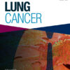 Lung Cancer PDF