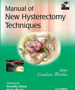 Manual of New Hysterectomy Techniques by Liselotte Mettler (PDF)