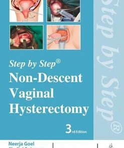 Step by Step: Non-Descent Vaginal Hysterectomy (PDF)