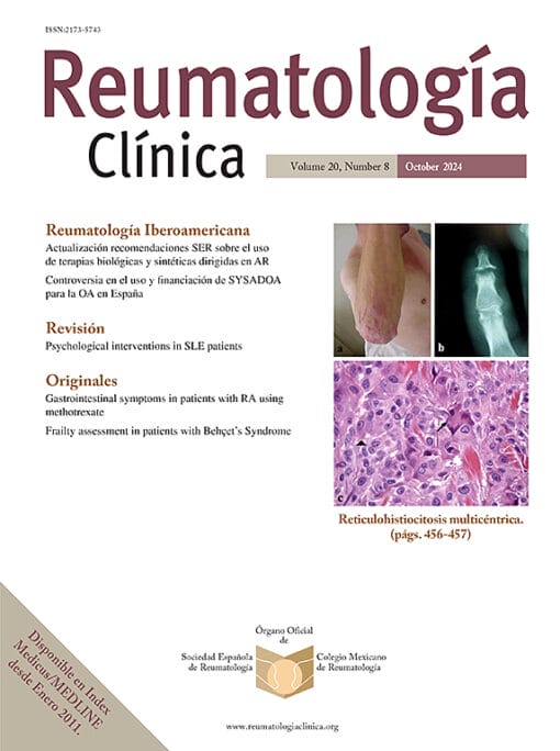 Reumatología Clínica (English Edition) PDF