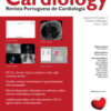 Revista Portuguesa de Cardiologia: Volume 43 (Issue 1 to Issue 5) 2024 PDF