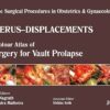 Single Surgical Procedures in Obstetrics and Gynaecology 20: A Colour Atlas of Surgery for Vault Prolapse: A.C.A.of Surgery for Vault Prolapse (Sspo&G) 1st Edition (PDF)