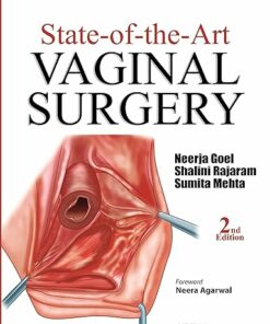 State-of-the-Art: Vaginal Surgery 2nd Edition (PDF)