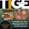 Techniques and Innovations in Gastrointestinal Endoscopy PDF