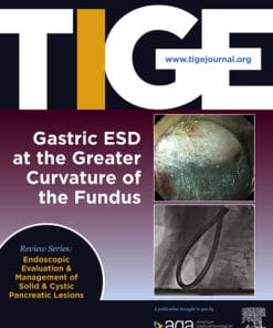 Techniques and Innovations in Gastrointestinal Endoscopy PDF