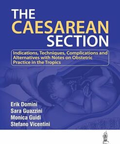 The Caesarean Section 1st Edition (PDF)