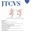 The Journal of Thoracic and Cardiovascular Surgery PDF