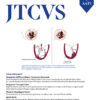 The Journal of Thoracic and Cardiovascular Surgery PDF