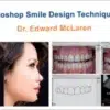 The Photoshop Smile Design Technique (PSD)