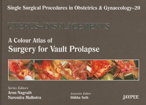 Uterus – Displacement: A Colour Atlas of Surgery for Vault Prolapse (Single Surgical Procedures in Obstetrics and Gynaecology) 1st Edition (PDF)