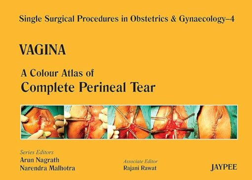 Single Surgical Procedures in Obstetrics and Gynaecology-04: Vagina-A Colour Atlas of Perineal Tear: A.C.A.of Complete Perineal Tear (Sspo&G Book 4) 1st Edition (PDF)