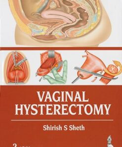 Vaginal Hysterectomy 2nd Edition (PDF)