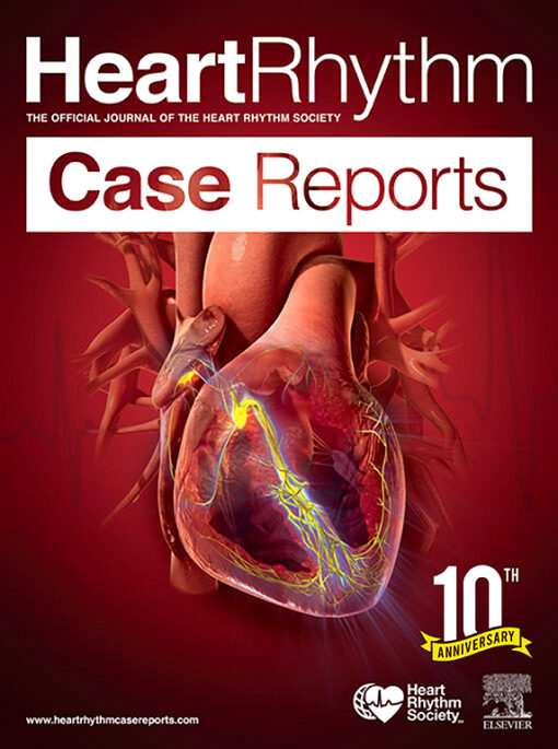 HeartRhythm Case Reports PDF