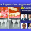 Bone Regeneration, Augmentation & Grafting, New Aspects