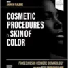 Procedures In Cosmetic Dermatology: Cosmetic Procedures In Skin Of Color (PDF)