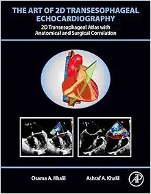 The Art Of 2D Transesophageal Echocardiography (Videos Only)