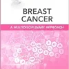 Breast Cancer: A Multidisciplinary Approach: Clinics Collections (Volume 14 -1) (EPub)