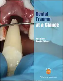 Dental Trauma At A Glance (At A Glance (Dentistry)) (PDF)