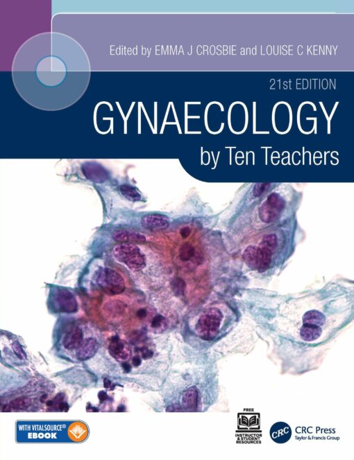 Gynaecology By Ten Teachers, 21st Edition (PDF)