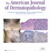 American Journal of Dermatopathology: Volume 44 (1 - 12) 2022 PDF