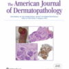 American Journal of Dermatopathology: Volume 45 (1 - 12) 2023 PDF