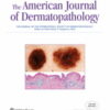 American Journal of Dermatopathology: Volume 45 (1 - 12) 2023 PDF